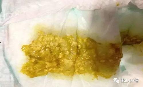 小孩便秘吃哈密瓜,天然食疗新选择